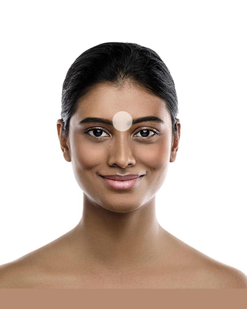 Entre cejo - Dr. Esteban Moreno