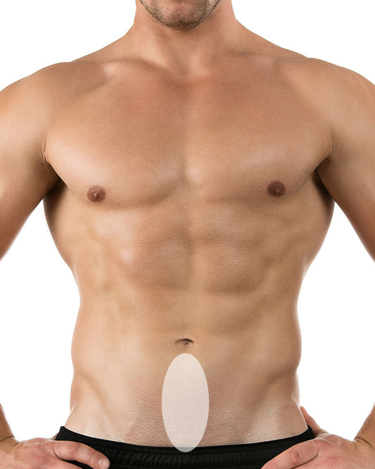 Linea alba - Dr. Esteban Moreno