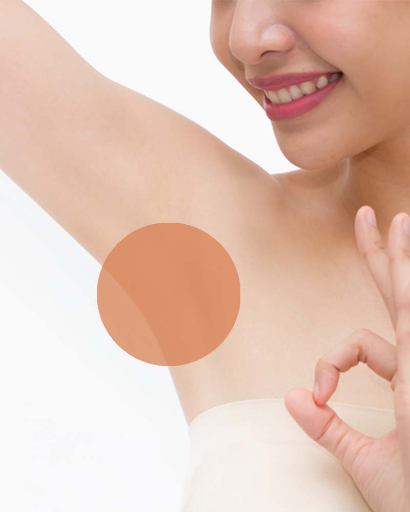 Axila - Dr. Esteban Moreno