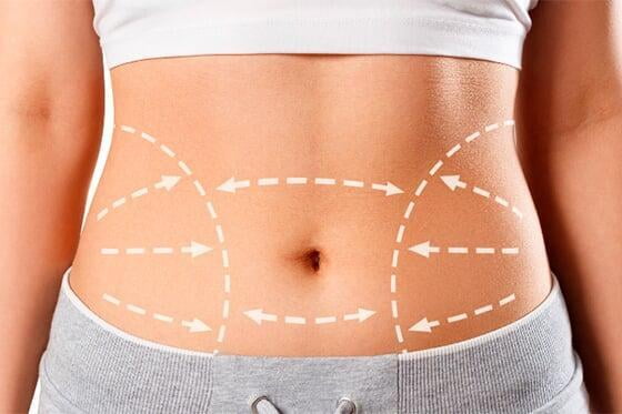 Tratamiento lipolitico abdominal (3 sesiones) - Dr. Esteban Moreno