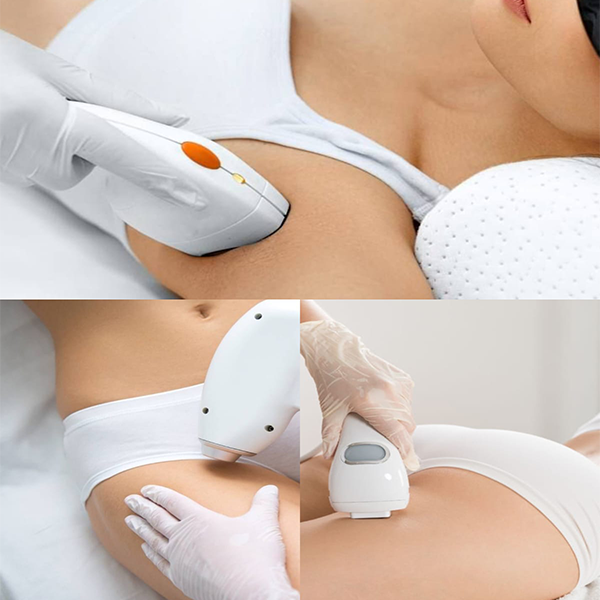 Axila, rebaje completo full brazilian y media pierna - Dr. Esteban Moreno