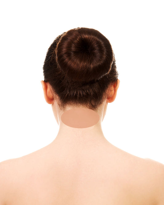 Cuello posterior solo nuca - Dr. Esteban Moreno