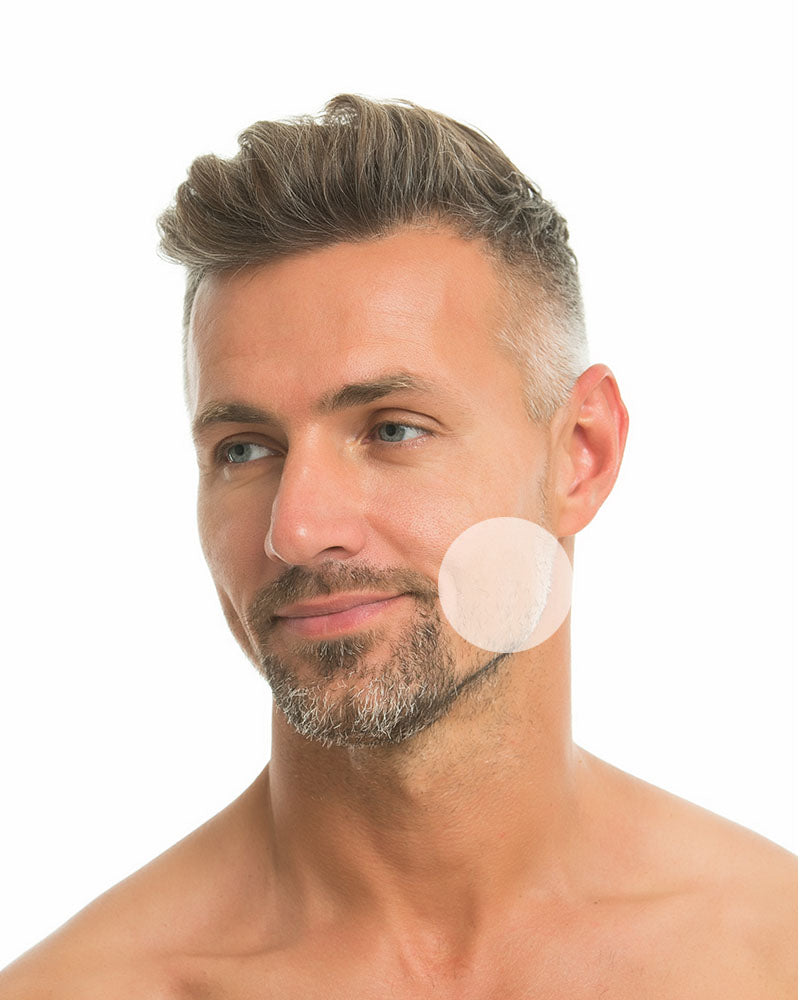 Barba completa - Dr. Esteban Moreno
