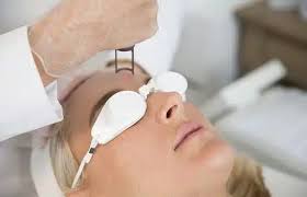 Eliminación de Manchas (Melasma, solares, postinflamatorias)